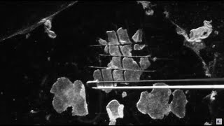 3 Methods for Passaging of Pluripotent Stem Cells [upl. by Jesher]