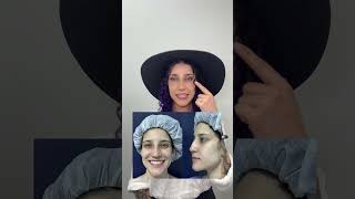 Testimonio Rinoplastia  Dra Lina Franco cirugiasplasticas belleza trending [upl. by Raab255]