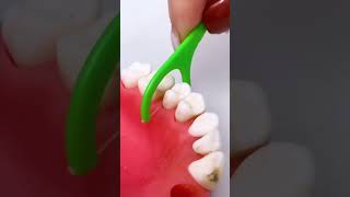 Best tool for teeth shortsvideo [upl. by Ludovico165]