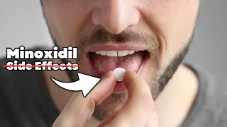 How to Avoid Oral MINOXIDIL Side Effects [upl. by Hanah]