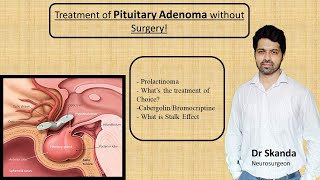 Pituitary Adenoma  Non Surgical treatment Cure without Operation Prolactinoma By Dr SkandaNSx [upl. by Faydra]