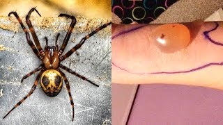 MOST Venomous Spiders On Earth [upl. by Ulrica]