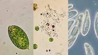 Microorganism moving methods  Flagella Pseudopodia and Cilia [upl. by Lehcar563]