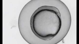 Zebrafish development movie  from gastrulation to 24 hours [upl. by Negem]