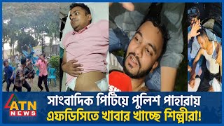 সাংবাদিক পিটিয়ে পুলিশ পাহারায় এফডিসিতে খাবার খাচ্ছে শিল্পীরা  BFDC Incident  Journalist [upl. by Mahgem]