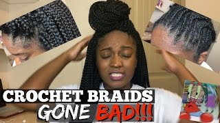 Crochet Braids Gone BAD Infection Allergic Reaction [upl. by Asselam]