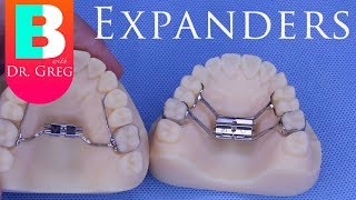 BRACES EXPLAINED Palatal Expanders [upl. by Broeker]