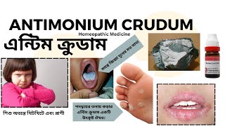 Antim Crud  Antimonium Crudum  Materia Medica  Learn antim crud easily [upl. by Adiaz]