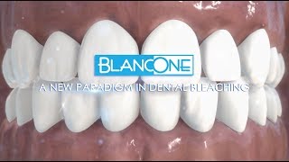 BlancOne reinvents dental bleaching subtitle [upl. by Aseel]