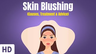 Skin Flushing or Blushing Everything You Need To Know [upl. by Groark566]