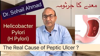 Helicobacter Pylori  The Cause of Peptic Ulcers Gastric amp Duodenal Ulcers  Urdu  Hindi [upl. by Bowers]