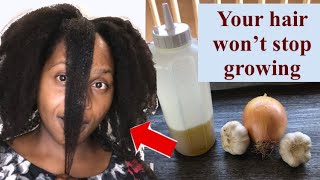 Onion and Garlic oil for hair growth HAIR LOSS HAIR THINNING BALDING Onion amp Garlic oil [upl. by Culosio]