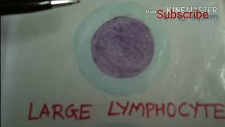 Small Lymphocytes and Large Lymphocytes [upl. by Noswad137]