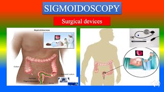 SIGMOIDOSCOPY Definition  parts uses  Precautions How to use   Surgical Devices [upl. by Okika806]