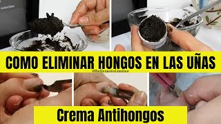 Crema Antihongos  Como Eliminar Hongos en las Uñas y en la Piel con Remedios Caseros [upl. by Nygem299]