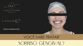 Você sabe tratar sorriso gengival [upl. by Noislla]