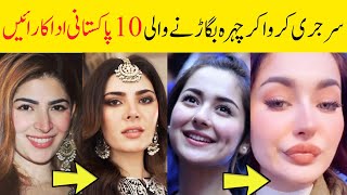 Actress face surgery haniaamir naimalkhawar ayezakhan nidayasir alizehshah yumnazaidi [upl. by Karlik]