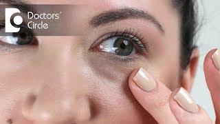 Causes of long lasting red splotcheses under the eyes  Dr Rasya Dixit [upl. by Buddie685]