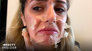 What It’s Like To Get A Chemical Peel For Acne Scars  Beauty Explorers  Beauty Insider [upl. by Ahseenyt]