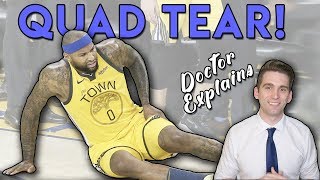 DeMarcus Cousins QUAD TEAR  Doctors ULTIMATE Guide [upl. by Minna]