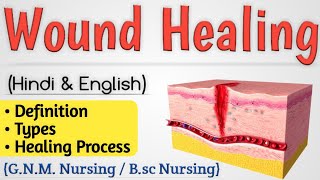 Wound Healing  Wound Healing Process In Hindi [upl. by Aisatnaf]