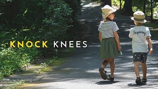 Knock Knee को कैसे ठीक करें  4 Best Exercises to Correct  Knock Knee problem solution knockknee [upl. by Ahsieuqal]