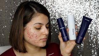 ACNE SKINCARE ROUTINE  Curology [upl. by Akerdal]