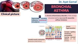 Signs and symptoms of bronchial asthma in brief for dentists [upl. by Any]