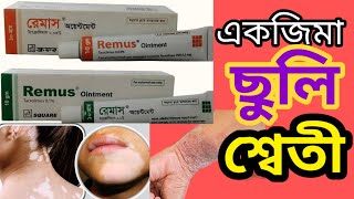 remus ointment 01 banglatacrolimus ointment 003 ww uses in banglaবিস্তারিত জেনে নিন [upl. by Tamar]