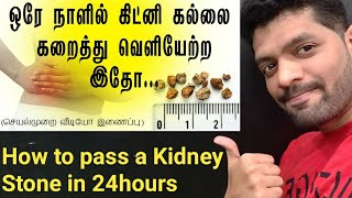 சிறுநீரக கல் சுலபமாக கரைய எளிய வழிHome Remedy to cure Kidney Stone in TamilKidney stone treatment [upl. by Zeba838]