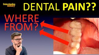 HOW TO KNOW Where the Dental Pain Comes From  pain in tooth after root canal treatment  CBCT [upl. by Annavoeg]