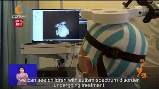 TMS Therapy in Autism Spectrum Disorder Light up Hope for Numerous Children with ASD [upl. by Iruy]