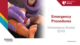 Emergency Procedures Intraosseous Access  EZIO [upl. by Jehovah]