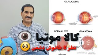 Eye  Glaucoma کالا موتیا  نظر کا خاموش دشمن [upl. by Anwahsat]