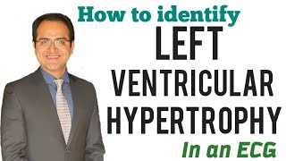 Left Ventricular Hypertrophy ECG Changes Skolow Lyon Criteria Explained ECG Lectures USMLE NEETPG [upl. by Eidod973]