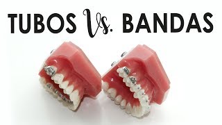 BANDAS Vs TUBOS  ¿QUÉ SON ¿CUÁL ES MEJOR [upl. by Marek178]