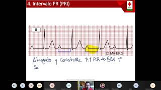 2 Lectura de Electrocardiograma [upl. by Matheny]