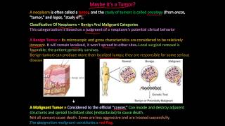 111P  What is a tumor Classification of Neoplasms  Benign and Malignant [upl. by Kalin]