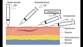 Intravenous IV Cannulation Procedures [upl. by Oiznun]