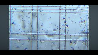 Yeast Cells on Counting Slide [upl. by Zerline]