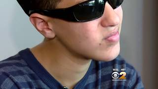 Vape Pen Explodes In Teen’s Face [upl. by Sophy]