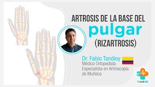 ARTROSIS de la base del pulgar Rizartrosis  Tu Salud Guía [upl. by Selyn]