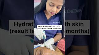 Skin booster hyaluronicacidskinvivejuvedermskinboostersmoothskinhydrationskincareinjection [upl. by Deyas]