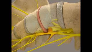 Spinal Decompression Supine [upl. by Baese]