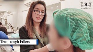 Tear Trough fillers  Under Eye Treatment  Dr Shaista lodhi from The Aesthetics Clinic [upl. by Doone]