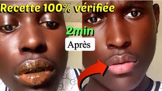 comment avoir les lèvres Roses en 2min  100 vérifiée [upl. by Ariem]