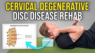 4 Exercises for Cervical Degenerative Disc Disease [upl. by Ranip345]