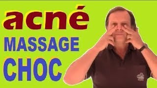 ACNE Ce Massage Naturel INCROYABLE Du Visage Enleve Les Boutons En 1 Mois [upl. by Haraf470]