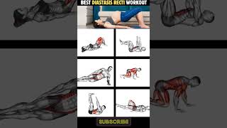 6 Best Diastasis Recti Workout Routine workout diastasisrectiexercises [upl. by Conrado65]