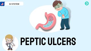 Peptic Ulcer Disease Everything you need to know [upl. by Ossy]